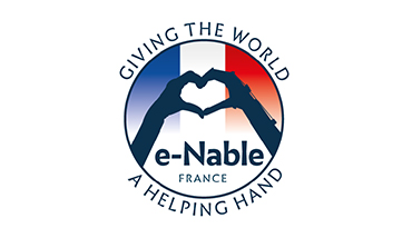 3D-TECHNOLOGIES HELP KIDS WITH AGENESIA ACCEPT ONE’S BODY