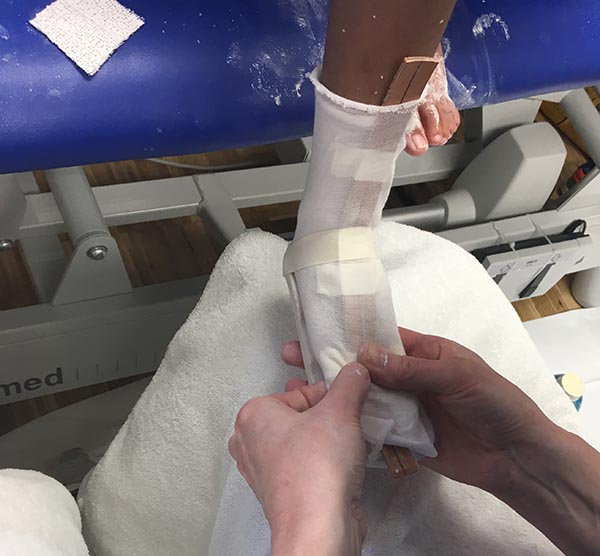 Phx_Preparing the foot_IMG_3386.JPG